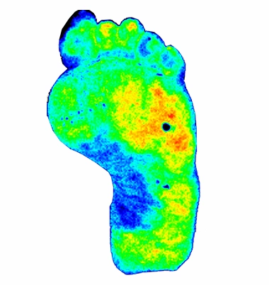 pericam psi hr diabetic foot