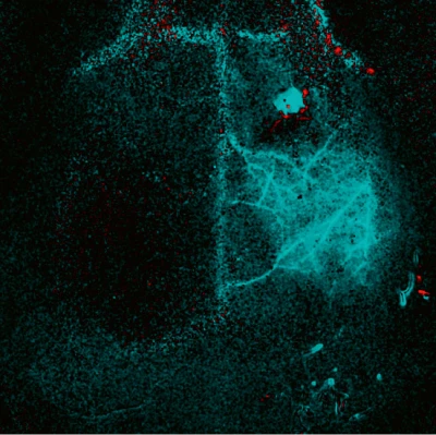 picture pericam psi mouse brain contrast